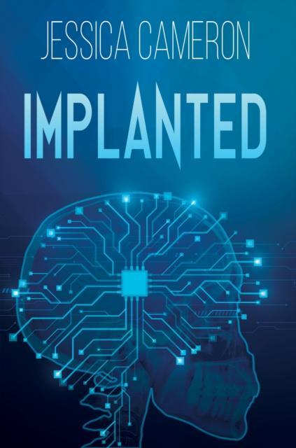 Implanted
