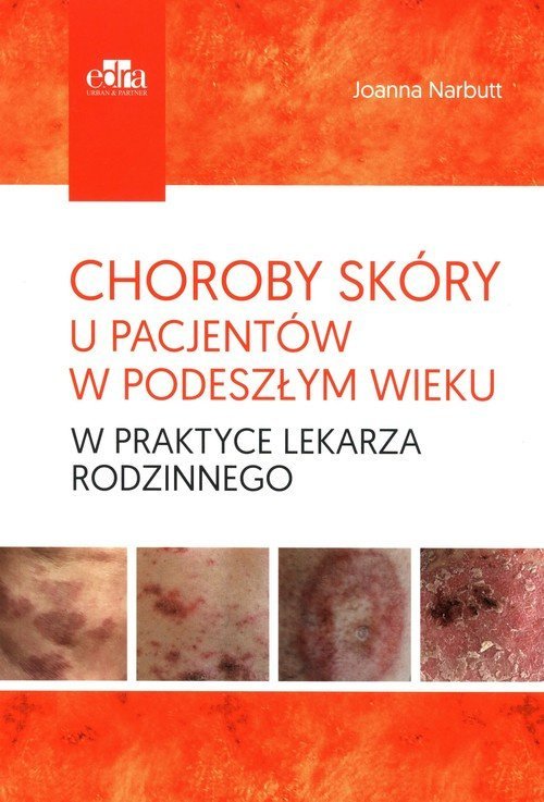 Edra Urban & Partner Choroby skóry u pacjentów w podeszłym wieku w praktyce lekarza rodzinnego