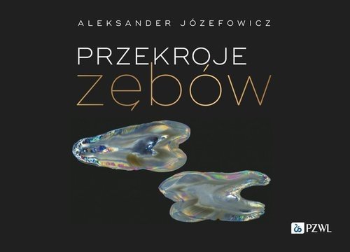 PZWL Przekroje zębów