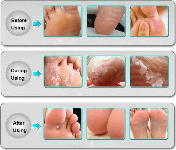 Apte AG493 Skarpetki Złuszczające na stopy peeling uniwersalny