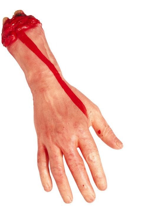 Blodig afrevet hånd