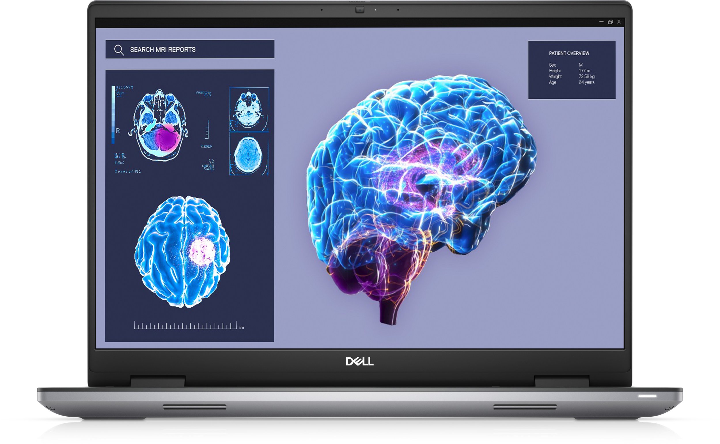 Laptop Dell DELL NTB Precision 7680/i7-13850HX/32GB/1TB/16" FHD+ /IR Cam & Mic/Nvidia RTX 2000/Backlit Kb/W11P/3Y PS NBD