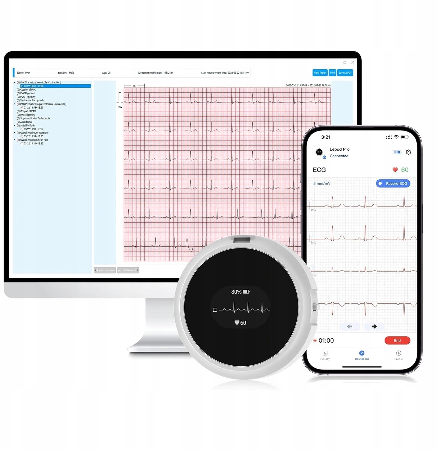 CheckMe LepodPro 12-kanałowe urządzenie EKG 24h zapis AI