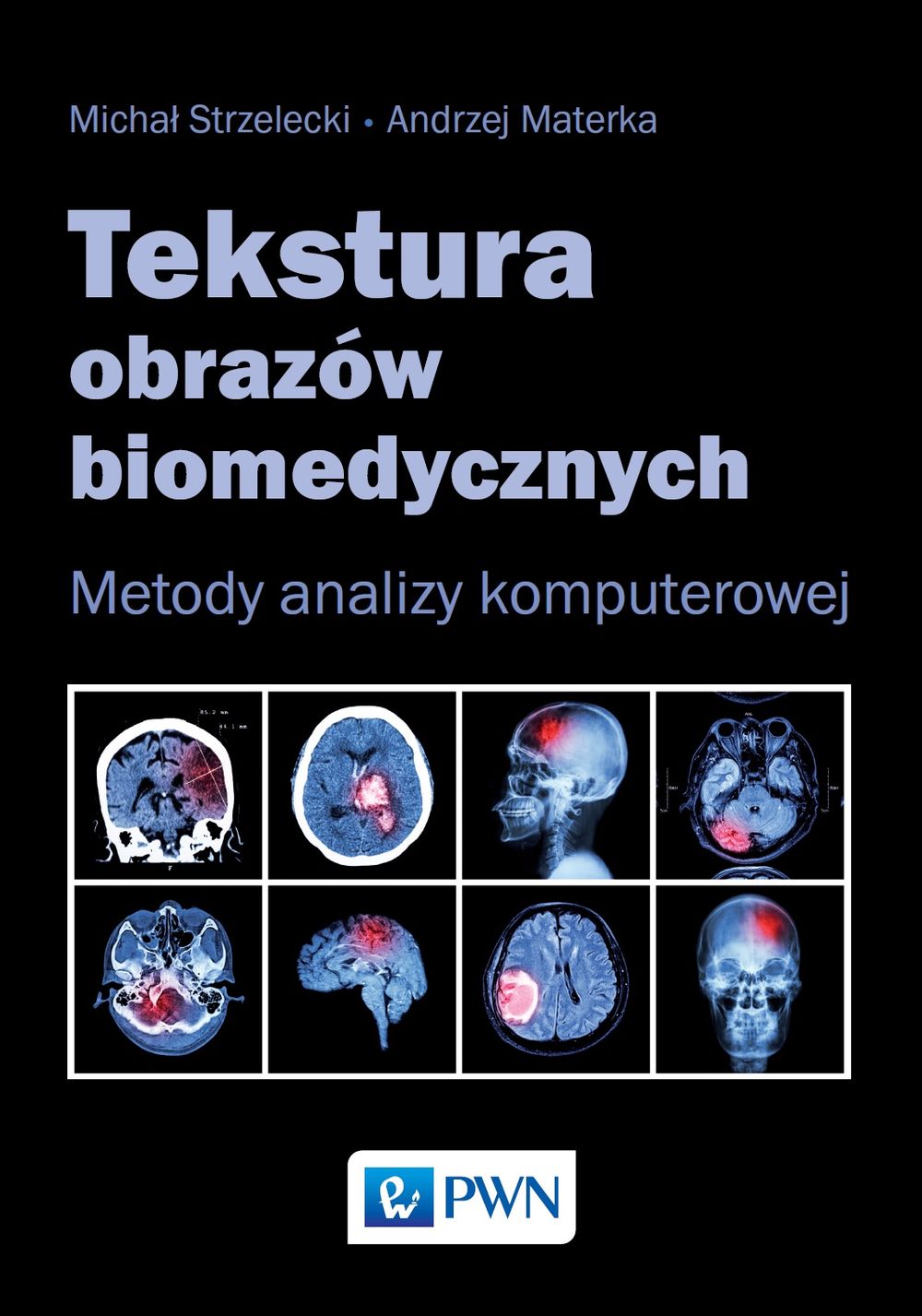 TEKSTURA OBRAZÓW BIOMEDYCZNYCH METODY ANALIZY KOMPUTEROWEJ
